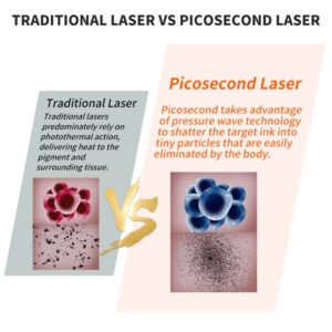 Máquina de eliminación de tatuajes con láser de picosegundos cerca de mí, antes y después del uso del láser de picosegundos.
