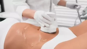 Welche Creme brauche ich für die Verwendung von Ultraschall-Kavitationsreduktionsgeräten? Leitfähiges Gel für Ultraschall-Kavitation
