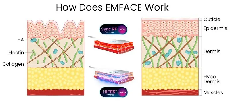 Emsface Shefmon