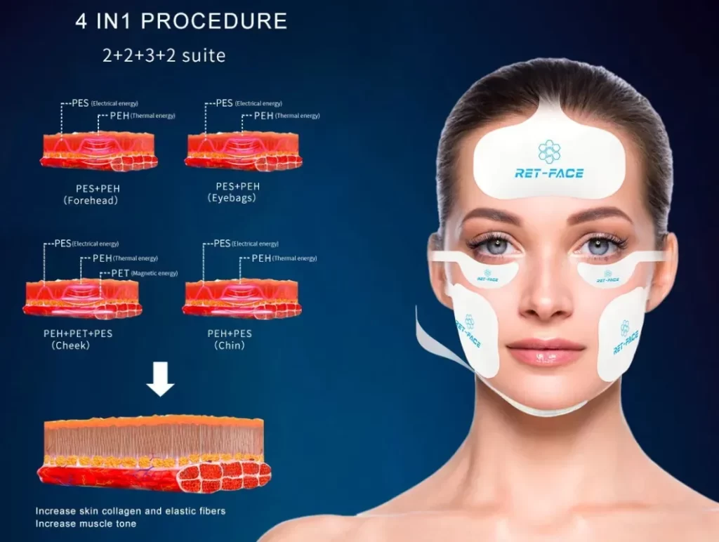 Máquina de beleza para escultura facial com estimulação muscular por radiofrequência Emface