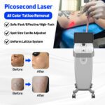 A0507 1064nm 532nm Q-switched Super Picosecond Picosure Yag Laser Tattoo Removal - Imagem 2