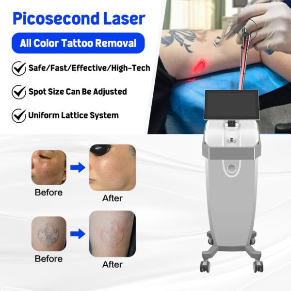A0507 1064nm 532nm Q-switched Super Picosecond Picosure Yag Laser Tattoo Removal - Imagem 2