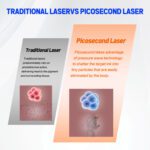A0507 1064nm 532nm Q-switched Super Picosecond Picosure Yag Laser Tattoo Removal - Imagem 4