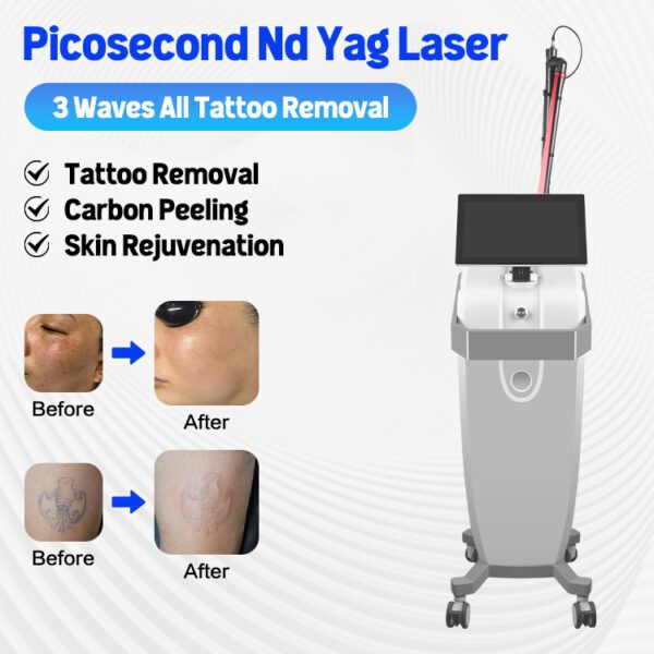 A0507 1064nm 532nm Q-switched Super Picosecond Picosure Yag Laser Tattoo Removal - Imagem 3
