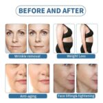 élimination des rides perte de poids anti-âge lifting et raffermissement du visage