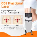 A0509 SHEFMON 2910nm Fiber Fractional CO2 Ultra Laser - Bild 3