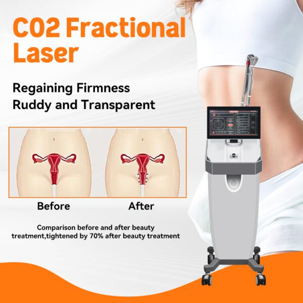 A0509 SHEFMON 2910nm Fiber Fractional CO2 Ultra Laser - Bild 3