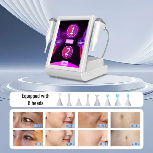 SHEFMON Coolplasma Cold Fusion Plasma Facial Skin Treatment Beauty Device A0145 - 画像 4