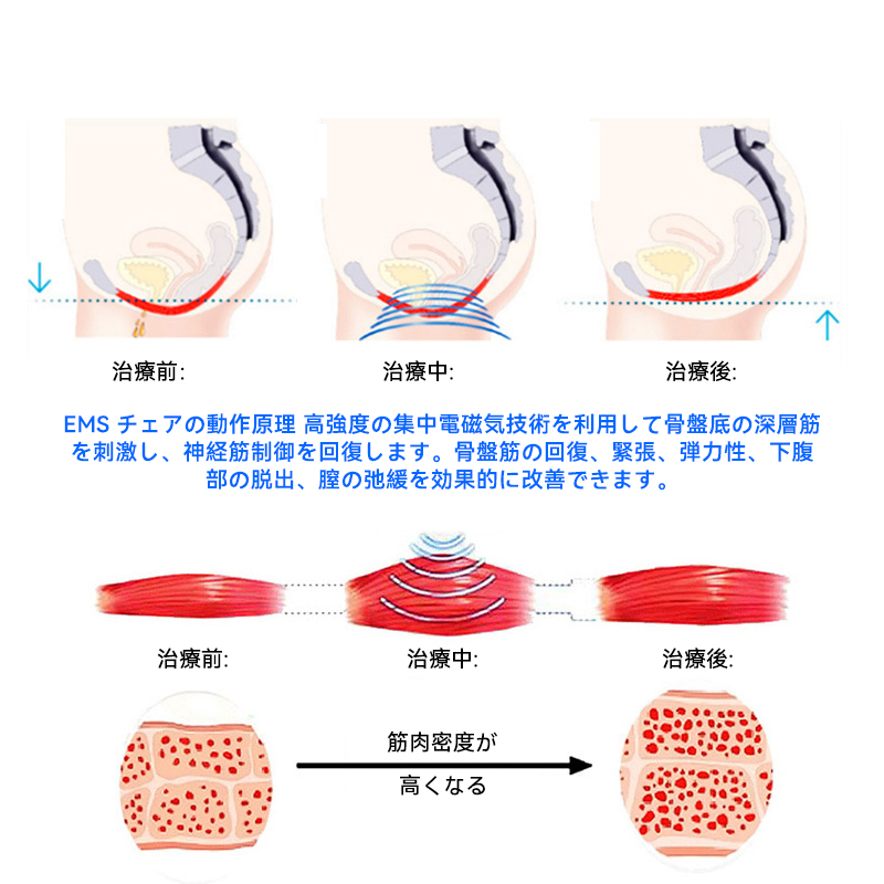 效果原理 1